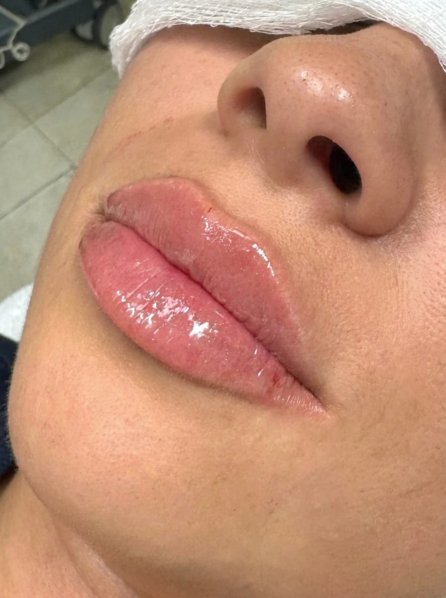 After — Hydration & balance