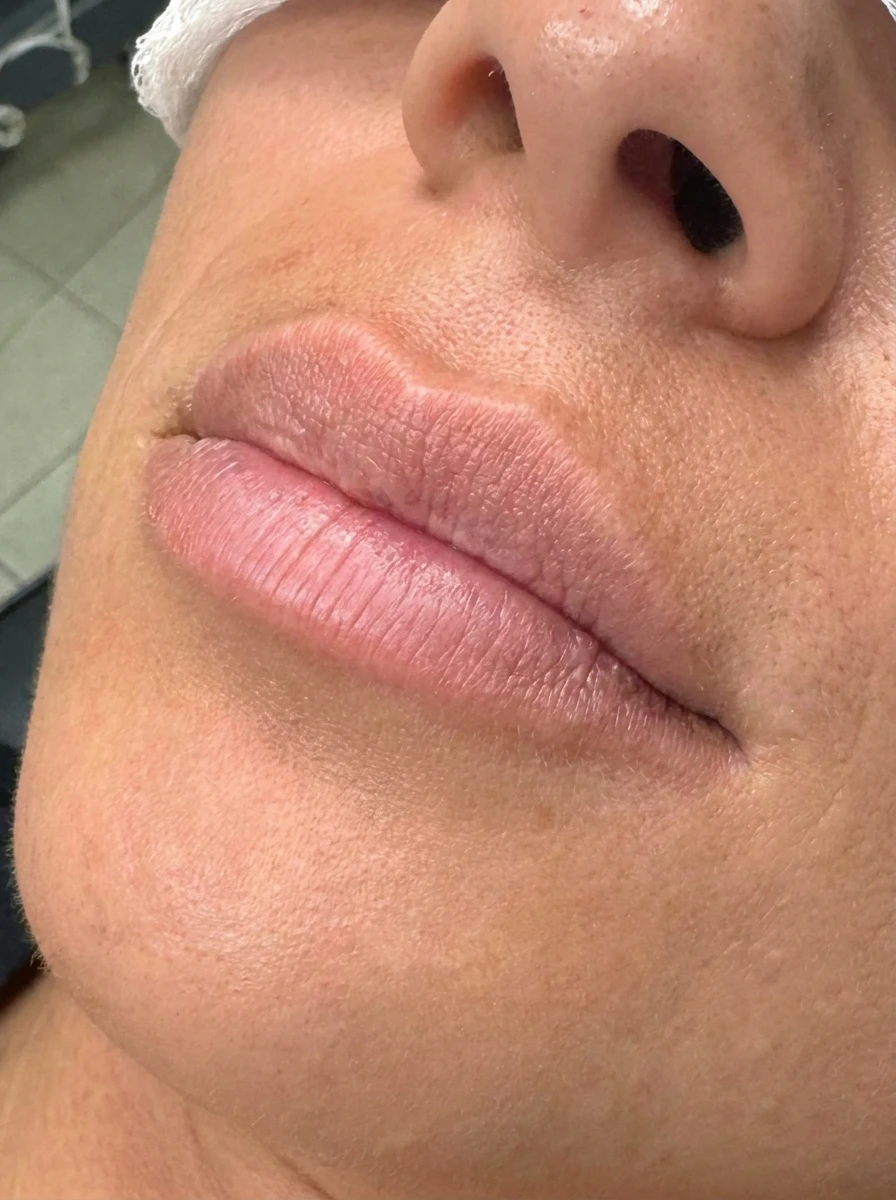 Before — Hydration & balance