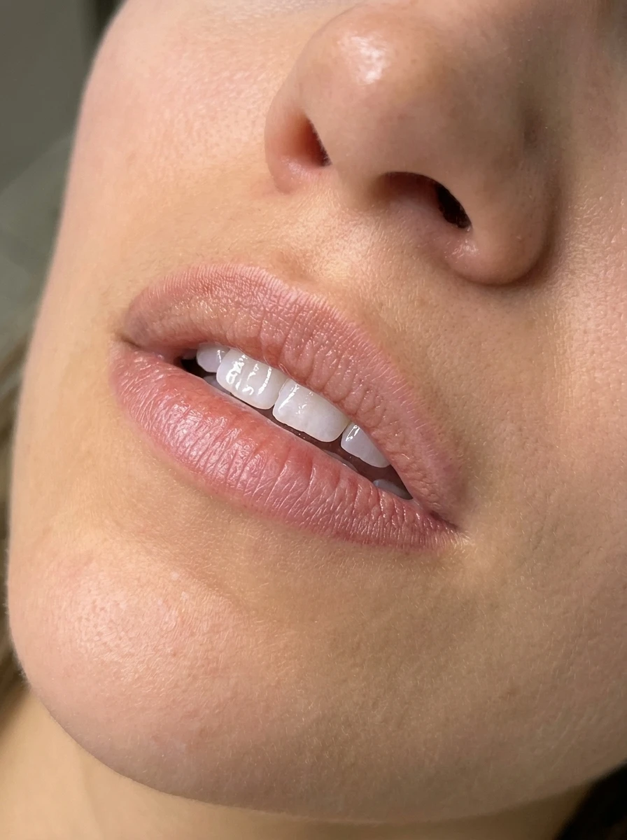 Before — Defined, yet natural