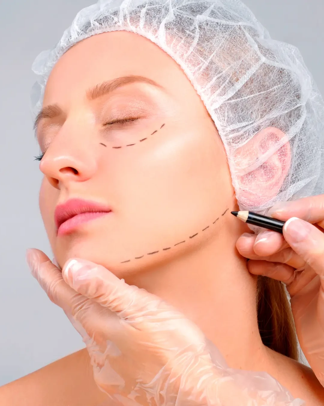 Facial Balancing at Klara's Needles, Davie, FL